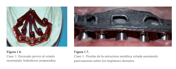 clinica-llobell-implantes-dentales