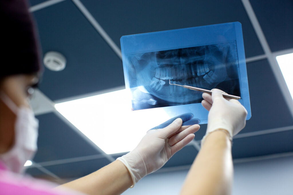 Un dentista revisa una radiografía dental