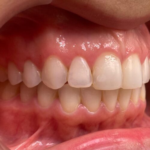 Finales odontologia estetica