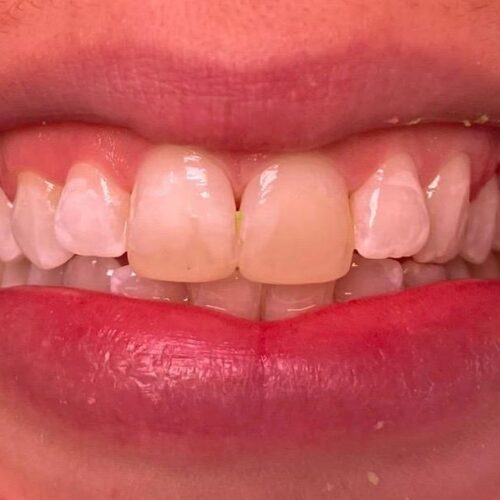 Odontologia conservdora