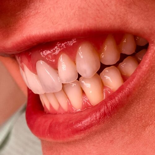 odontologia menos invasiva 2