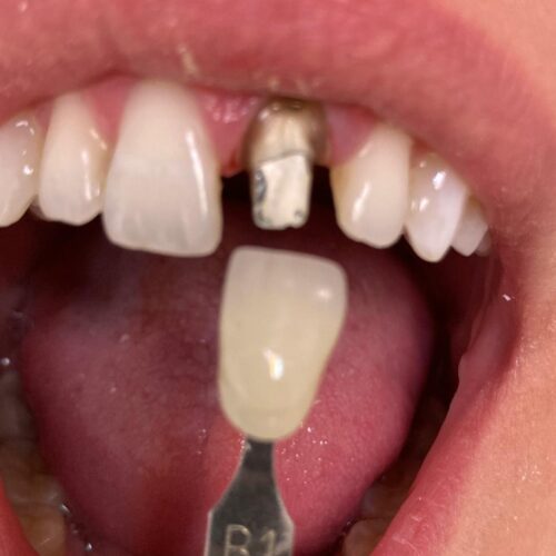 odontologia menos invasiva 3