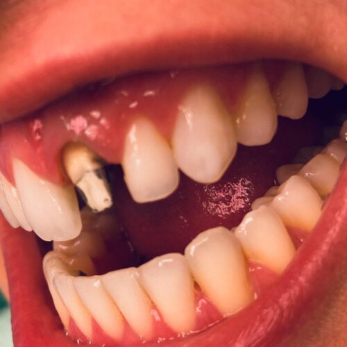 odontologia menos invasiva